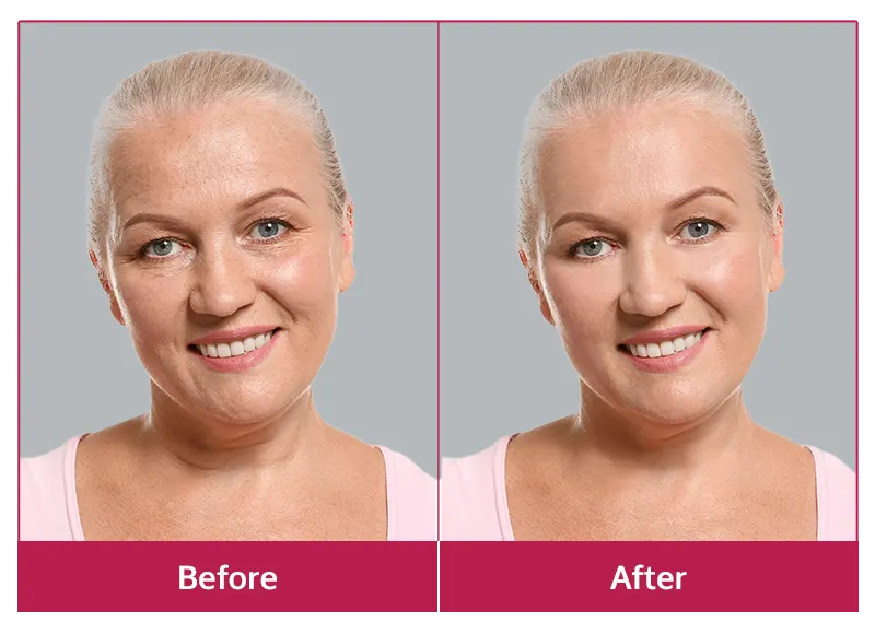 Glowic Customer Reviews